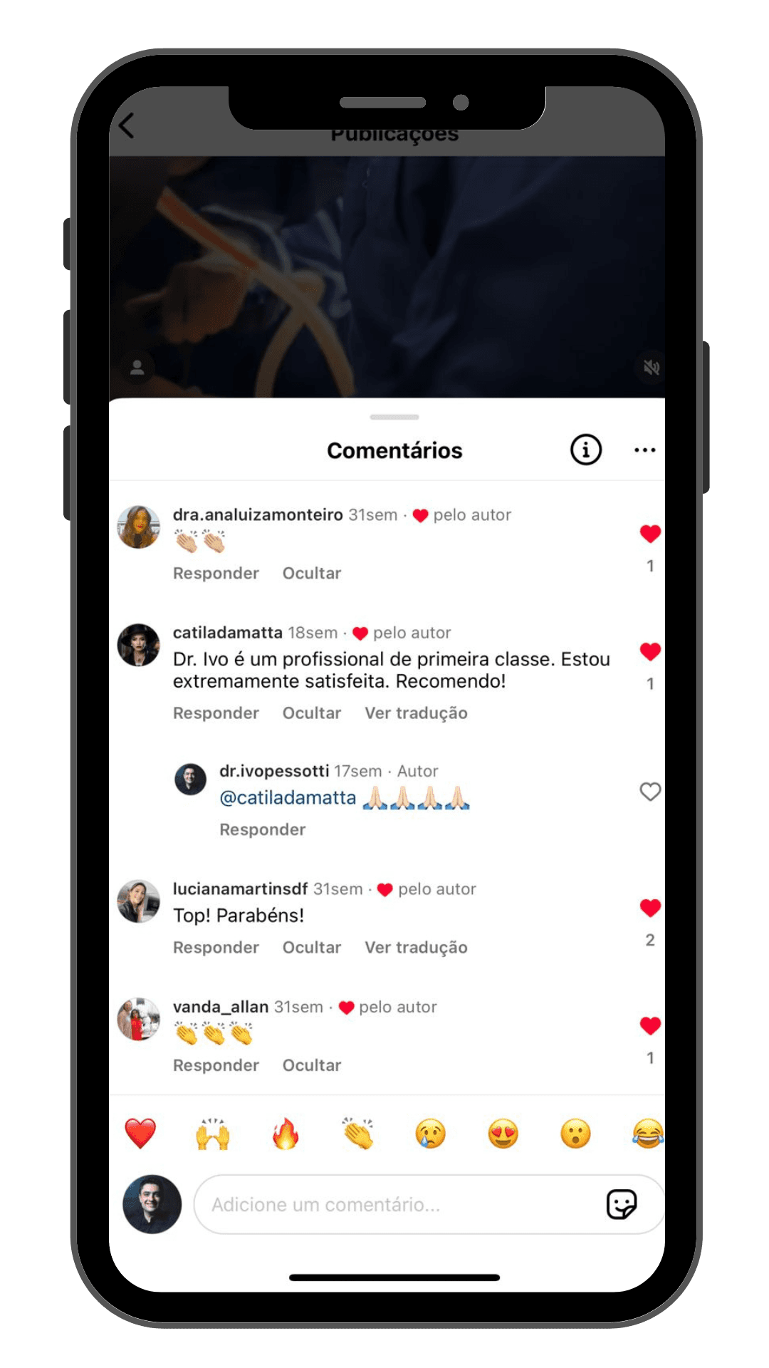 Comentários do instagram